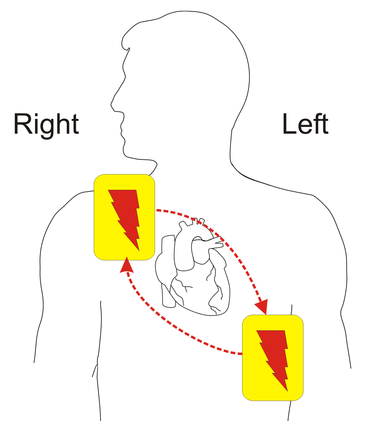 Cpr+aed | automated external defibrillator  cpr training 