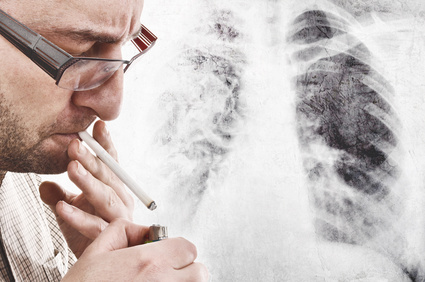 Lung Cancer and Smoking?, Risk Factors, Quiting, Cancer, Lung, Smokin